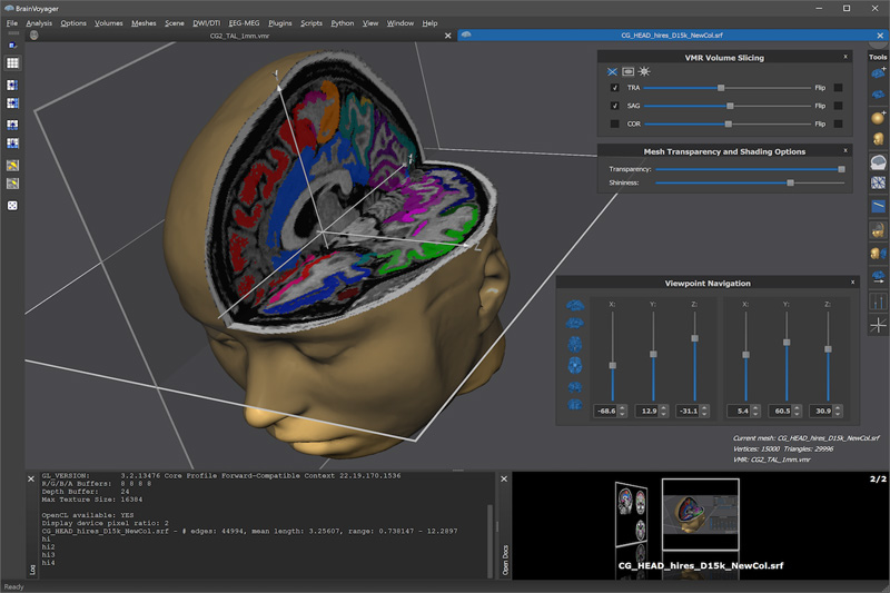 画像:BrainVoyager | 脳機能 イメージング ソフトウェア パッケージ