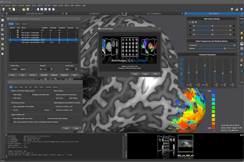 BrainVoyager | 脳機能 イメージング ソフトウェア パッケージ