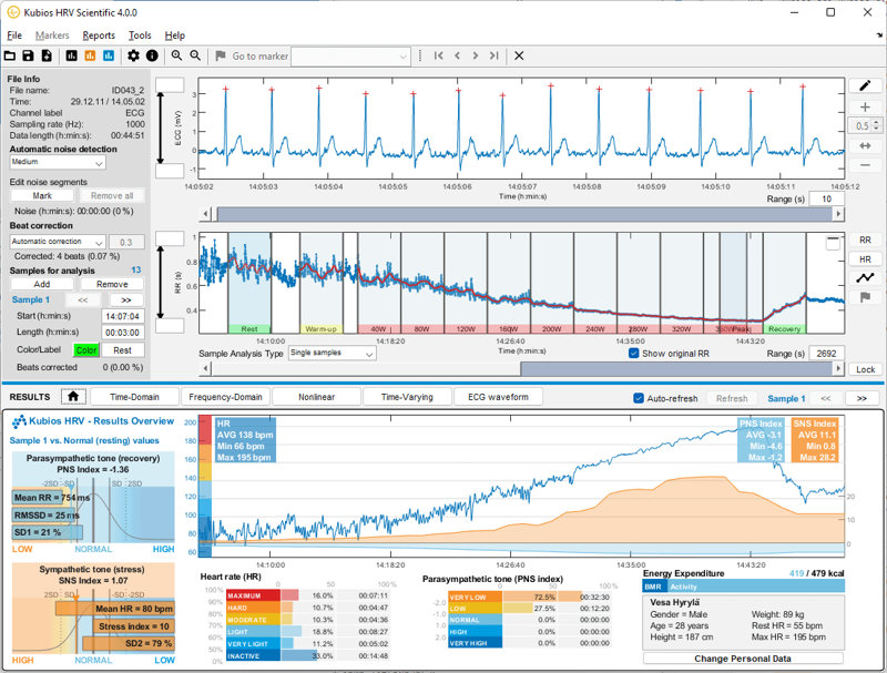 Kubios HRV Scientific | HRV 心拍変動 分析ツール