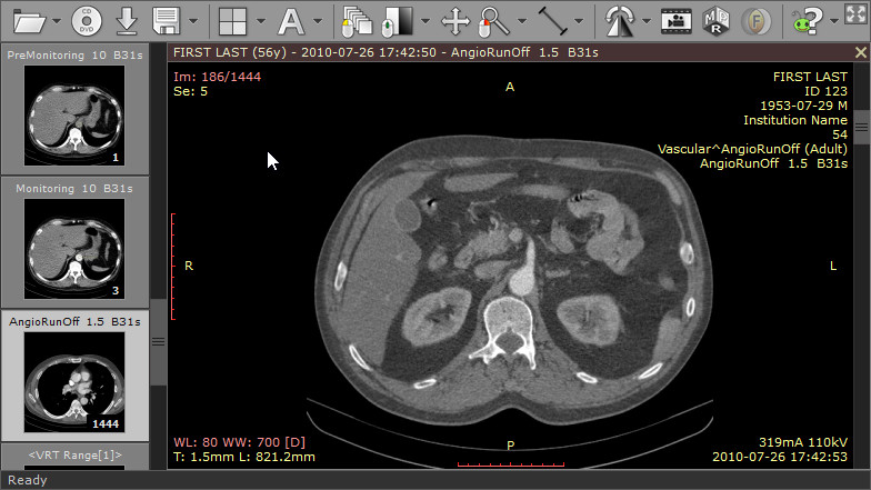 RadiAnt DICOM Viewer | 研究 学習 医用画像 ビューア