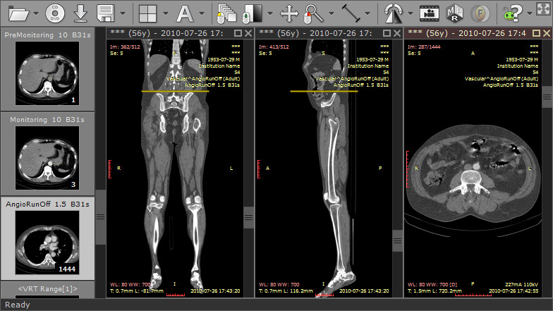 RadiAnt DICOM Viewer | 研究 学習 医用画像 ビューア