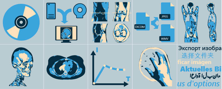 RadiAnt DICOM Viewer | 研究 学習 医用画像 ビューア